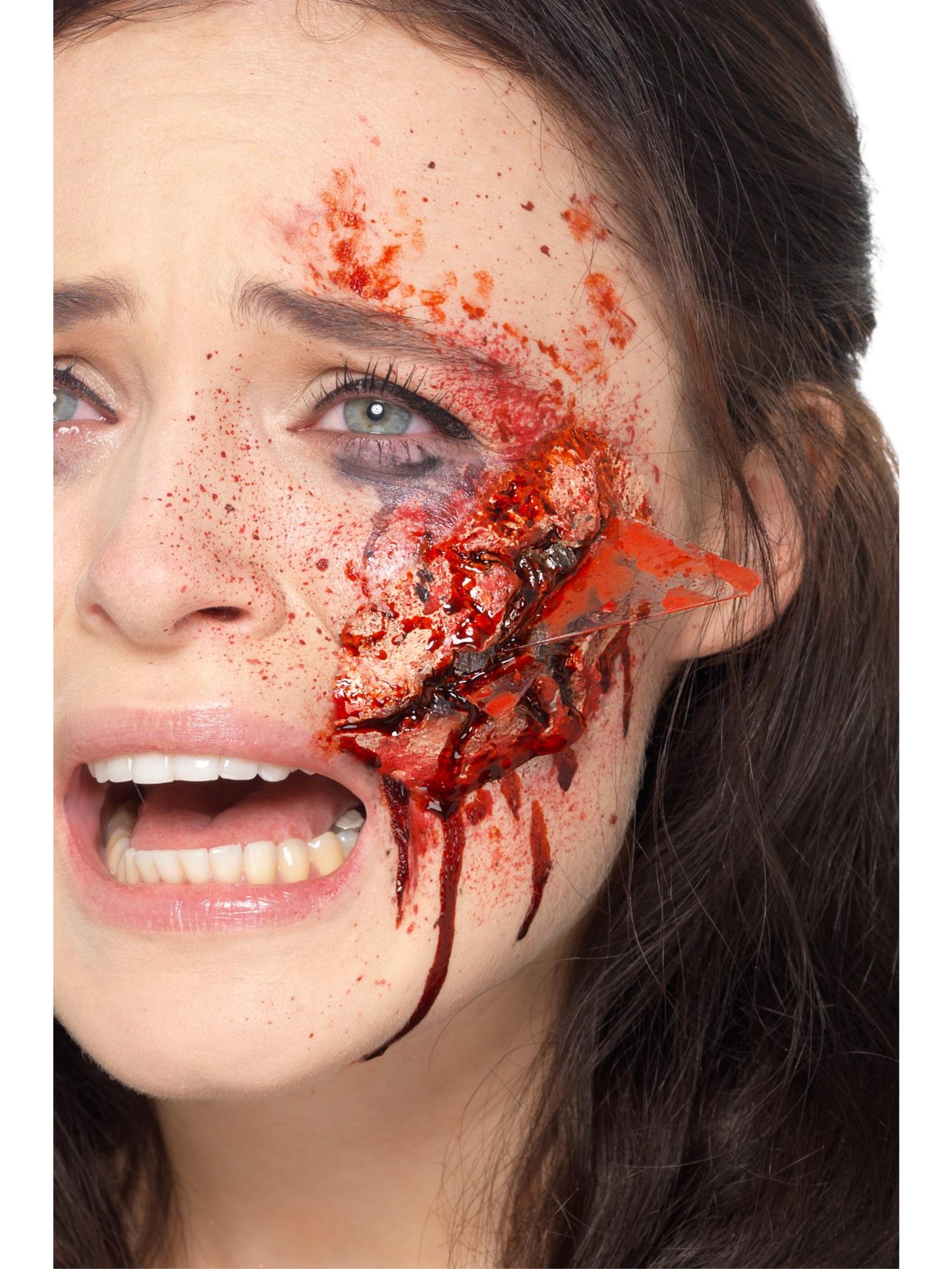 Prosthetics